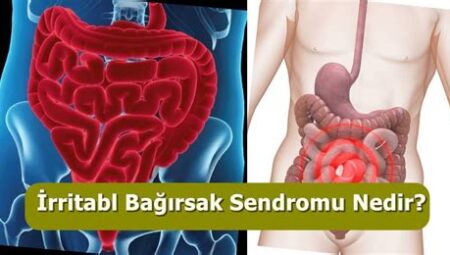 İrritabl Bağırsak Sendromu (IBS) Belirtileri