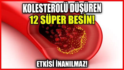 "Yüksek Kolesterolü Düşürme Yöntemleri"